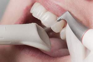 чистка зубов без боли